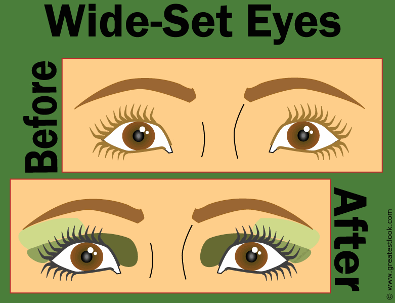wide set eyes vs close set eyes